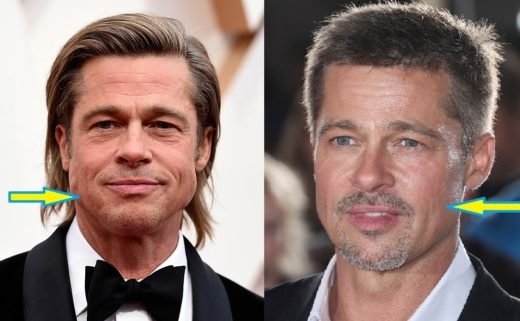 Brad Pitt Aging Gracefully or Under the Knife 2
